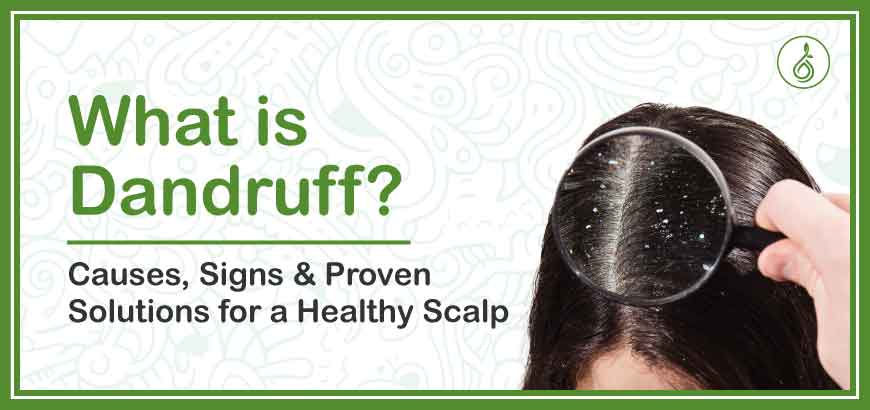 what is dandruff