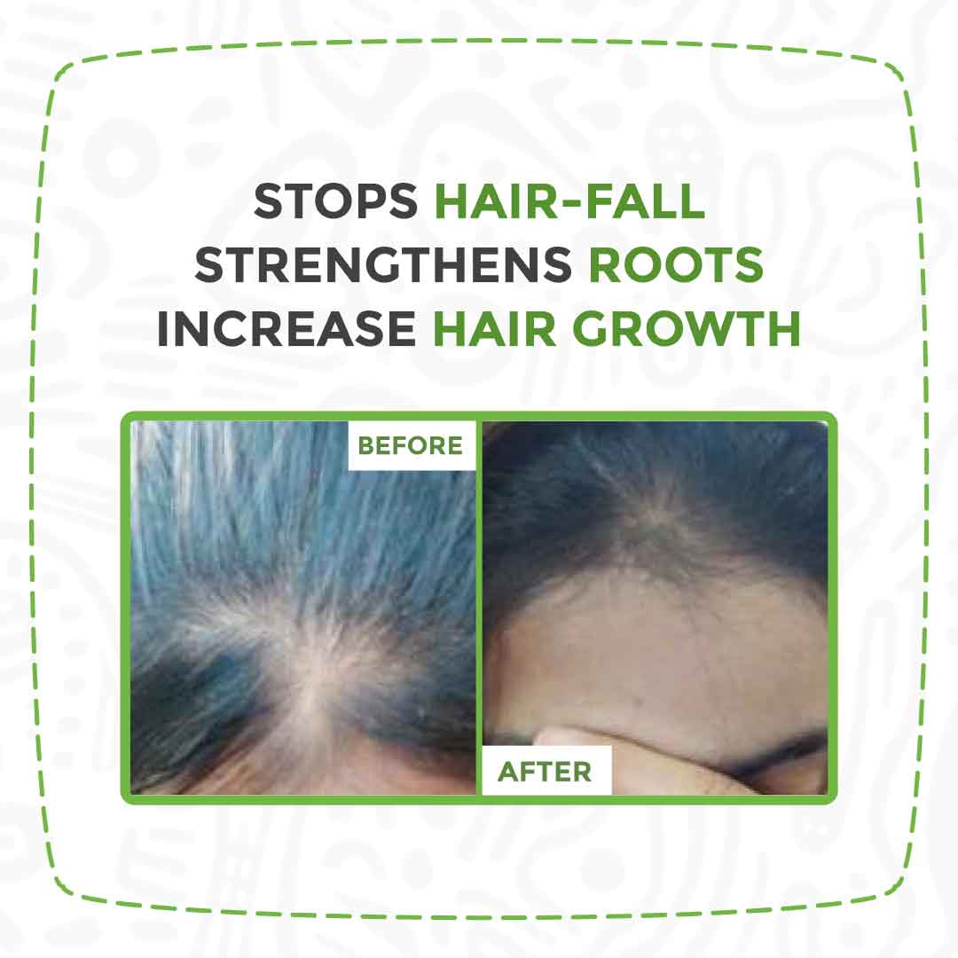 Anti Hair Fall and Hair Growth Oil Before and After